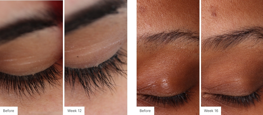 Neora’s Lash Lush before and afters
